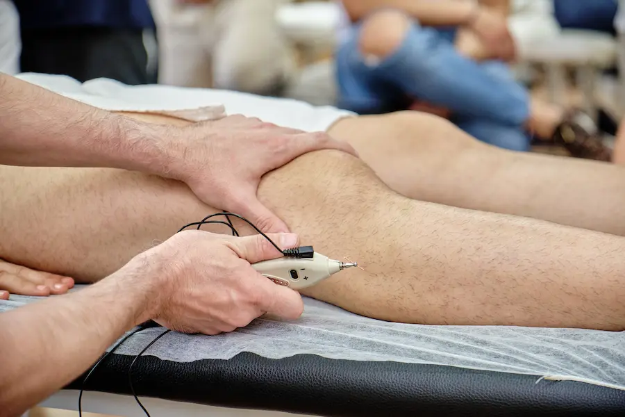 estudiar acupuntura en madrid